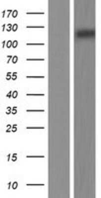 Western Blot: MERTK Overexpression Lysate (Adult Normal) [NBP2-07636] Left-Empty vector transfected control cell lysate (HEK293 cell lysate); Right -Over-expression Lysate for MERTK.