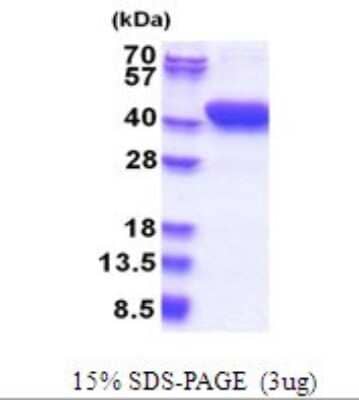 SDS-PAGE Recombinant Human MESDC1 His Protein