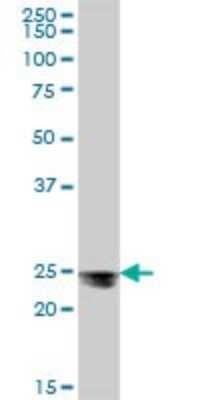Western Blot: MESDC2 Antibody [H00023184-B01P] - Analysis of MESDC2 expression in human liver.