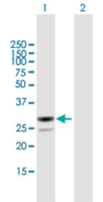 Western Blot: MESDC2 Antibody [H00023184-B01P] - Analysis of MESDC2 expression in transfected 293T cell line by MESDC2 polyclonal antibody.  Lane 1: MESDC2 transfected lysate(25.74 KDa). Lane 2: Non-transfected lysate.