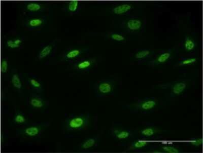 Immunocytochemistry/Immunofluorescence: MESP2 Antibody (1C8) [H00145873-M01] - Analysis of monoclonal antibody to MESP2 on HeLa cell . Antibody concentration 10 ug/ml.