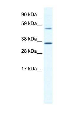 Western Blot: MESP2 Antibody [NBP1-80219] - SP2/0 cell lysate, concentration 1.25ug/ml.