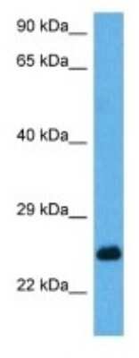 Western Blot: MESP2 Antibody [NBP3-10989] - Western blot analysis of MESP2 in Mouse Brain lysates. Antibody dilution at 1ug/ml