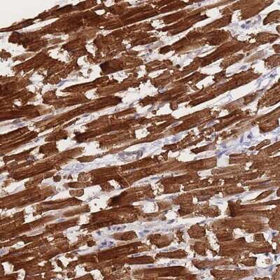 Immunohistochemistry-Paraffin: Meteorin Antibody [NBP2-14231] - Staining of human heart muscle shows strong cytoplasmic positivity in myocytes.