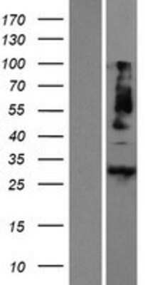 Western Blot: METRN Overexpression Lysate (Adult Normal) [NBP2-06365] Left-Empty vector transfected control cell lysate (HEK293 cell lysate); Right -Over-expression Lysate for METRN.