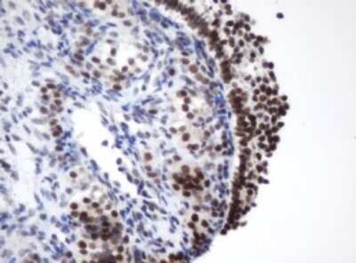 Immunohistochemistry: METT10D Antibody (3E8) [NBP2-45823] - Analysis of Human Ovary tissue. (Heat-induced epitope retrieval by 10mM citric buffer, pH6.0, 120C for 3min)