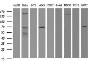 Western Blot: METT10D Antibody (3E8) [NBP2-45823] - Analysis of extracts (35ug) from 9 different cell lines (HepG2: human; HeLa: human; SVT2: mouse; A549: human; COS7: monkey; Jurkat: human; MDCK: canine; PC12: rat; MCF7: human).
