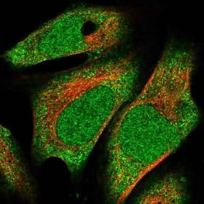 Immunocytochemistry/Immunofluorescence: METT10D Antibody [NBP1-81239] - Staining of human cell line U-2 OS shows localization to nucleoplasm & cytosol. Antibody staining is shown in green.