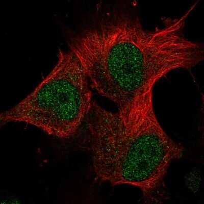 Immunocytochemistry/Immunofluorescence: METT10D Antibody [NBP2-56696] - Staining of human cell line U-251 MG shows localization to nucleoplasm. Antibody staining is shown in green.