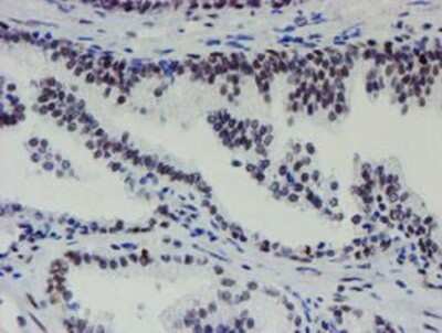 Immunohistochemistry: METT10D Antibody (OTI3B5) - Azide and BSA Free [NBP2-72654] - Staining of paraffin-embedded Human prostate tissue using anti-METT10D mouse monoclonal antibody.