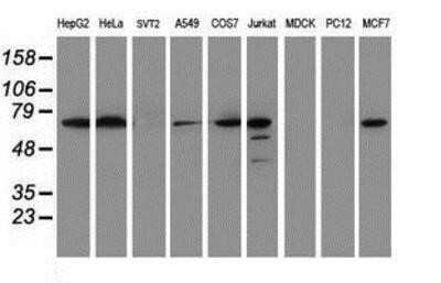 Western Blot: METT10D Antibody (OTI3B5) - Azide and BSA Free [NBP2-72654] - Analysis of extracts (35ug) from 9 different cell lines by using g anti-METT10D monoclonal antibody (HepG2: human; HeLa: human; SVT2: mouse; A549: human; COS7: monkey; Jurkat: human; MDCK: canine; PC12: rat; MCF7: human).