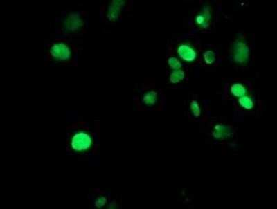 Immunocytochemistry/Immunofluorescence: METT10D Antibody (OTI3B5) [NBP2-02026] - Staining of COS7 cells transiently transfected by pCMV6-ENTRY METT10D.