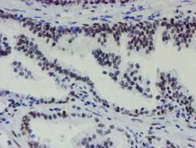 Immunohistochemistry-Paraffin: METT10D Antibody (OTI3B5) [NBP2-02026] - Staining of paraffin-embedded Human prostate tissue using anti-METT10D mouse monoclonal antibody.