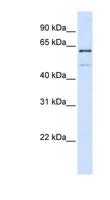 Western Blot: METT10D Antibody [NBP1-79255] - 293T cells lysate, concentration 0.2-1 ug/ml.