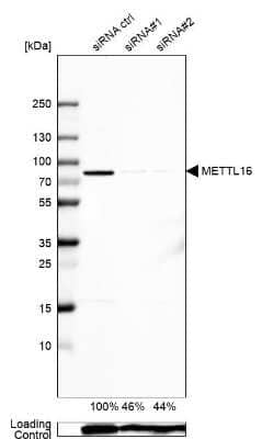 Western Blot: METT10D Antibody [NBP1-81239] - Analysis in Caco-2 cells transfected with control siRNA, target specific siRNA probe #1 and #2,. Remaining relative intensity is presented. Loading control: Anti-GAPDH.