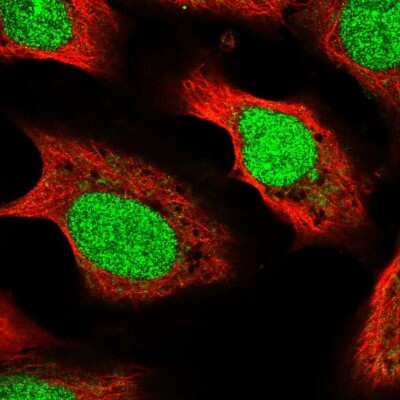 Immunocytochemistry/ Immunofluorescence METT11D1 Antibody - BSA Free