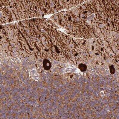 Immunohistochemistry-Paraffin METT11D1 Antibody - BSA Free