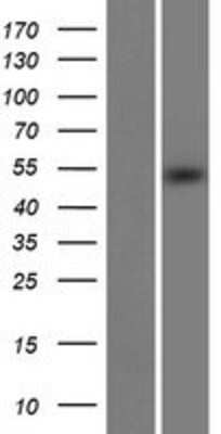 Western Blot: METT11D1 Overexpression Lysate (Adult Normal) [NBP2-11609] Left-Empty vector transfected control cell lysate (HEK293 cell lysate); Right -Over-expression Lysate for METT11D1.