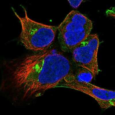 Immunocytochemistry/Immunofluorescence: METT5D1 Antibody [NBP2-58462] - Staining of human cell line HEK 293 shows localization to plasma membrane & the Golgi apparatus. Antibody staining is shown in green.