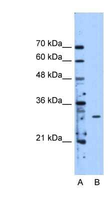 Western Blot: METTL1 Antibody [NBP1-54928] - HepG2 cell lysate, concentration 2.5 ug/ml.