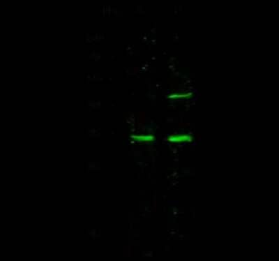 Western Blot: METTL1 Antibody [NBP2-99811] - Anti-METTL1 rabbit polyclonal antibody at 1:500 dilution. Lane A: Jurkat Whole Cell Lysate. Lane B: 293T Whole Cell Lysate. Lysates/proteins at 30 ug per lane. Secondary Goat Anti-Rabbit IgG H&L (Dylight 800) at 1/10000 dilution. Developed using the Odyssey technique. Performed under reducing conditions. Predicted band size: 31 kDa. Observed band size: 34 kDa (We are unsure as to the identity of these extra bands).