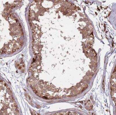 Immunohistochemistry-Paraffin: METTL10 Antibody [NBP2-14232] - Staining of human testis shows moderate cytoplasmic positivity in cells in seminiferous ducts.