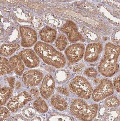Immunohistochemistry-Paraffin: METTL10 Antibody [NBP2-14232] - Staining of human kidney shows moderate cytoplasmic positivity in cells in tubules.