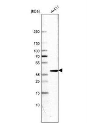 Western Blot: METTL10 Antibody [NBP2-14232] - Analysis in human cell line A-431.
