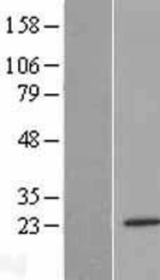 Western Blot: METTL10 Overexpression Lysate (Adult Normal) [NBP2-04473] Left-Empty vector transfected control cell lysate (HEK293 cell lysate); Right -Over-expression Lysate for METTL10.