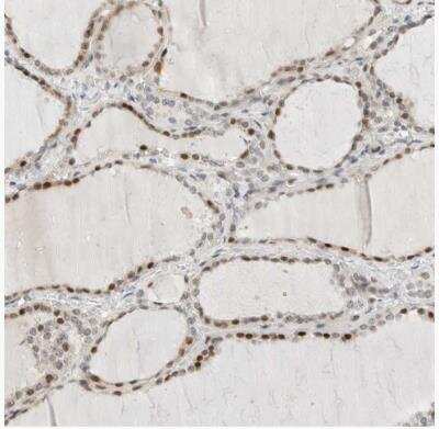 Immunohistochemistry-Paraffin: METTL11B Antibody [NBP1-88494] -  Staining of human thyroid gland shows moderate to strong nuclear positivity in glandular cells.
