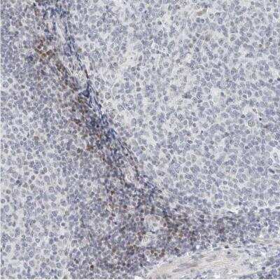 Immunohistochemistry-Paraffin: METTL11B Antibody [NBP1-88494] -  Staining of human tonsil shows weak to moderate nuclear positivity in non - germinal center cells.