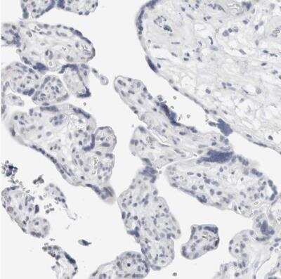 Immunohistochemistry-Paraffin: METTL11B Antibody [NBP1-88494] - Staining of human placenta shows no positivity in trophoblastic cells as expected.