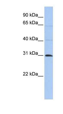 Western Blot: METTL11B Antibody [NBP1-70635] - HepG2 cell lysate, concentration 0.2-1 ug/ml.