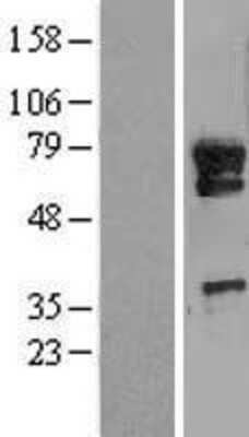 Western Blot: METTL13 Overexpression Lysate (Adult Normal) [NBL1-12256] Left-Empty vector transfected control cell lysate (HEK293 cell lysate); Right -Over-expression Lysate for METTL13.