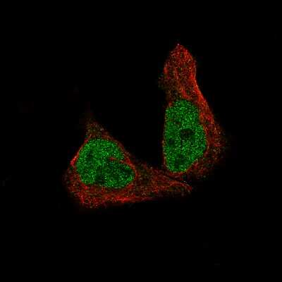 Immunocytochemistry/Immunofluorescence: METTL14 Antibody (CL4252) [NBP2-59043] - Staining of RH-30 cells using the Anti-METTL14 monoclonal antibody, showing specific staining in the nucleoplasm in green. Microtubule- and nuclear probes are visualized in red and blue, respectively (where available).