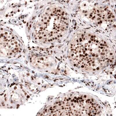 Immunohistochemistry-Paraffin: METTL14 Antibody (CL4252) [NBP2-59043] - Staining of human testis shows strong nuclear positivity in cells in seminiferous ducts.