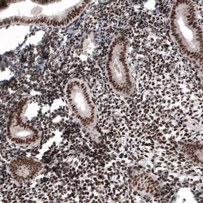 Immunohistochemistry-Paraffin: METTL14 Antibody (CL4252) [NBP2-59043] - Staining of human endometrium shows strong nuclear positivity in glandular and stromal cells.