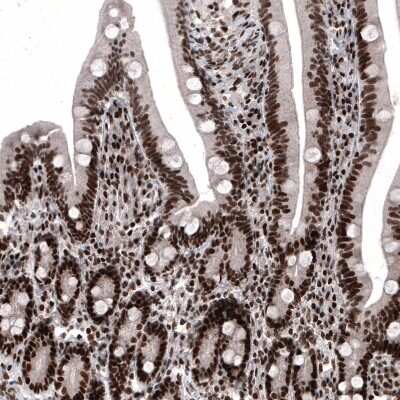 Immunohistochemistry-Paraffin: METTL14 Antibody (CL4252) [NBP2-59043] - Staining of human duodenum shows strong nuclear positivity in glandular cells.