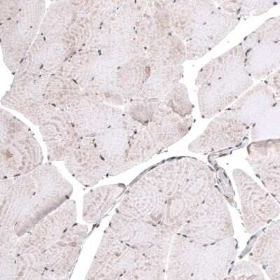 Immunohistochemistry-Paraffin: METTL14 Antibody (CL4252) [NBP2-59043] - Staining of human skeletal muscle shows only weak nuclear positivity in striated muscle fibers.