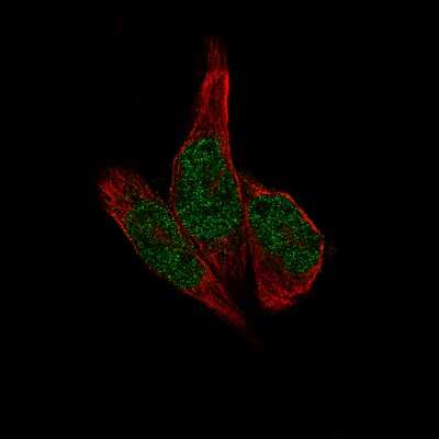 Immunocytochemistry/Immunofluorescence: METTL14 Antibody (CL4254) [NBP2-59044] - Staining of RH-30 cells using the Anti-METTL14 monoclonal antibody, showing specific staining in the nucleoplasm in green. Microtubule- and nuclear probes are visualized in red and blue, respectively (where available).