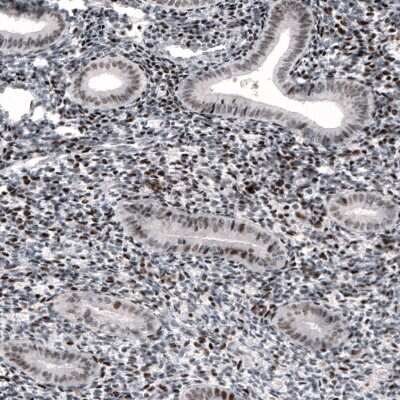 Immunohistochemistry-Paraffin: METTL14 Antibody (CL4254) [NBP2-59044] - Staining of human endometrium shows nuclear immunoreactivity in glandular cells and in stroma.