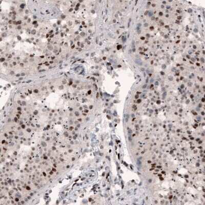Immunohistochemistry-Paraffin: METTL14 Antibody (CL4254) [NBP2-59044] - Staining of human testis shows nuclear positivity in cells in seminiferous tubules.