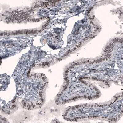 Immunohistochemistry-Paraffin: METTL14 Antibody (CL4254) [NBP2-59044] - Staining of human fallopian tube shows nuclear immunoreactivity in glandular cells.