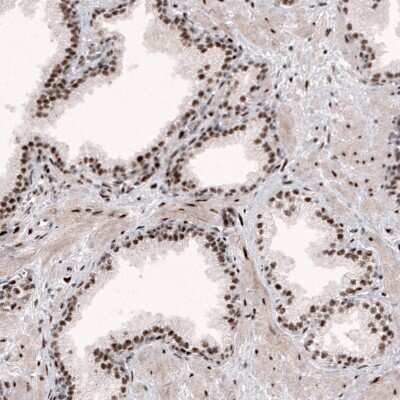 Immunohistochemistry-Paraffin: METTL14 Antibody (CL4254) [NBP2-59044] - Staining of human prostate shows strong nuclear positivity in glandular cells and in smooth muscle cells.