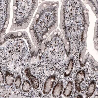 Immunohistochemistry-Paraffin: METTL14 Antibody (CL4254) [NBP2-59044] - Staining of human duodenum shows strong nuclear immunoreactivity in glandular cells and in the connective tissue.
