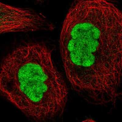 Immunocytochemistry/ Immunofluorescence METTL14 Antibody - BSA Free
