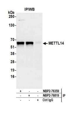 METTL14 Antibody [NBP2-76819] - Detection of human METTL14 by western blot of immunoprecipitates. Samples: Whole cell lysate (1.0 mg per IP reaction; 20% of IP loaded) from Jurkat cells prepared using NETN lysis buffer. Antibodies: Affinity purified rabbit anti-METTL14 antibody NBP2-76819 used for IP at 15 ul per reaction. METTL14 was also immunoprecipitated by rabbit anti-METTL14 antibody NBP2-76359. Detection: Chemiluminescence with an exposure time of 3 seconds.