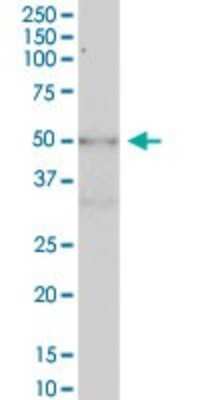 Western Blot: METTL14 Antibody [H00057721-B01P] - Analysis of KIAA1627 expression in human placenta.