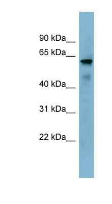 Western Blot: METTL14 Antibody [NBP1-79389] - Titration: 0.2-1 ug/ml, Positive Control: NCI-H226 cell lysate.