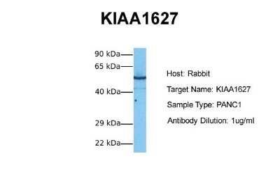 Western Blot: METTL14 Antibody [NBP1-79389] - Sample Tissue: Human PANC1 Antibody Dilution: 1.0 ug/ml
